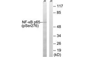 Western blot analysis of extracts from Jurkat cells, using NF-kappaB p65 (Phospho-Ser276) Antibody. (NF-kB p65 Antikörper  (pSer276))
