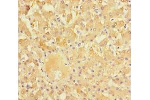 Immunohistochemistry of paraffin-embedded human liver tissue using ABIN7161898 at dilution of 1:100 (NR1I3 Antikörper  (AA 2-351))