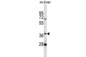 Western Blotting (WB) image for anti-Paroxysmal Nonkinesigenic Dyskinesia (PNKD) antibody (ABIN2996825) (PNKD Antikörper)