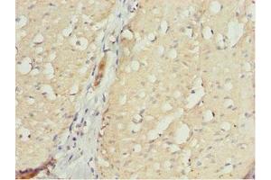 Immunohistochemistry of paraffin-embedded human small intestine tissue using ABIN7161725 at dilution of 1:100 (NLE1 Antikörper  (AA 206-485))
