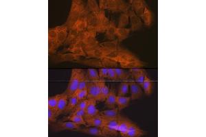 Immunofluorescence analysis of C6 cells using TBK1/NAK Rabbit mAb (ABIN7270723) at dilution of 1:100 (40x lens). (TBK1 Antikörper)