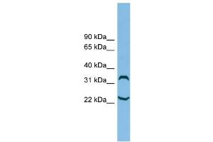 WB Suggested Anti-C6orf134 Antibody Titration: 0. (Chromosome 6 Open Reading Frame 134 (C6orf134) (N-Term) Antikörper)