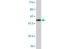 Western Blot detection against Immunogen (54. (SNAP29 Antikörper  (AA 1-258))