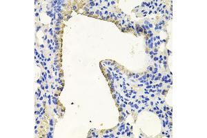 Immunohistochemistry of paraffin-embedded mouse lung using PKN1 antibody (ABIN6003498) at dilution of 1/100 (40x lens). (PKN1 Antikörper)