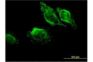 Immunofluorescence of monoclonal antibody to MAPRE3 on HeLa cell. (MAPRE3 Antikörper  (AA 125-218))