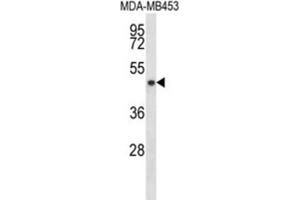 Western Blotting (WB) image for anti-Sirtuin 3 (SIRT3) antibody (ABIN2998084) (SIRT3 Antikörper)