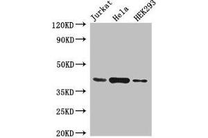 Western Blot Positive WB detected in: Jurkat whole cell lysate, Hela whole cell lysate, HEK293 whole cell lysate All lanes: HLA-C antibody at 4 μg/mL Secondary Goat polyclonal to rabbit IgG at 1/50000 dilution Predicted band size: 41 kDa Observed band size: 41 kDa (HLA-C Antikörper  (AA 25-308))