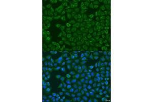 Immunofluorescence analysis of U2OS cells using FMO5 antibody (ABIN2736763) at dilution of 1:100. (FMO5 Antikörper)