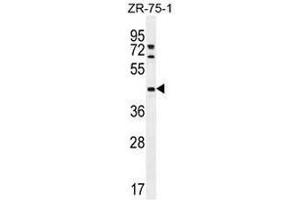 METTL2 Antikörper  (C-Term)