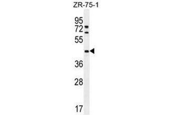 METTL2 Antikörper  (C-Term)