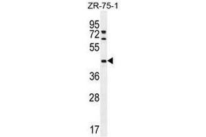 METTL2 Antibody (C-term) western blot analysis in ZR-75-1 cell line lysates (35µg/lane). (METTL2 Antikörper  (C-Term))