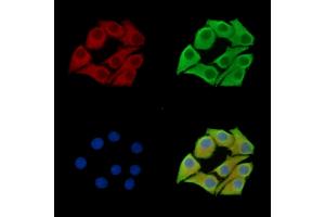 ABIN7097159 and ABIN7101227 staining Hela cells by IF/ICC.