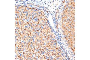 Immunohistochemistry of paraffin-embedded rat ovary using G1 Rabbit mAb (ABIN7265446) at dilution of 1:100 (40x lens). (gamma 1 Adaptin Antikörper)