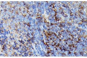 Immunohistochemistry of paraffin-embedded Rat spleen using HLA-B Polyclonal Antibody at dilution of 1:100 (40x lens). (HLA-B Antikörper)