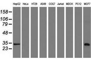 Western blot analysis of extracts (35 µg) from 9 different cell lines by using anti-SULT2A1 monoclonal antibody. (SULT2A1 Antikörper)