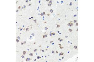 Immunohistochemistry of paraffin-embedded mouse brain using DLG1 antibody at dilution of 1:100 (x40 lens).