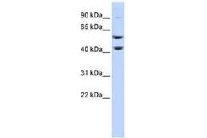 Image no. 1 for anti-ATPase, H+ Transporting, Lysosomal 56/58kDa, V1 Subunit B2 (ATP6V1B2) (C-Term) antibody (ABIN6744046) (ATP6V1B2 Antikörper  (C-Term))