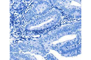 Immunohistochemistry (IHC) image for anti-Cullin 4A (CUL4A) antibody (ABIN1872121) (Cullin 4A Antikörper)