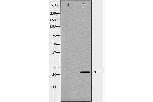 Western blot analysis of Hela whole cell lysates, using SDC2 Antibody. (Syndecan 2 Antikörper  (C-Term))
