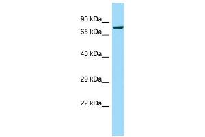 WB Suggested Anti-CAPN8 Antibody Titration: 1.