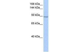 Western Blotting (WB) image for anti-Hexokinase 2 (HK2) antibody (ABIN2459729) (Hexokinase 2 Antikörper)