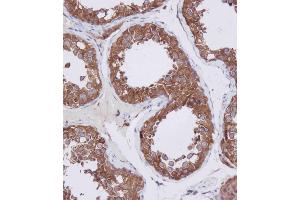 Immunohistochemical analysis of A on paraffin-embedded Human testis tissue. (HDAC6 Antikörper  (C-Term))