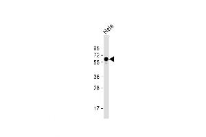 Western Blot at 1:1000 dilution + Hela whole cell lysate Lysates/proteins at 20 ug per lane. (PKM2 Antikörper  (C-Term))