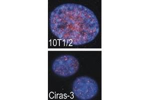 Indirect IF analysis showed that RSKB is localized in the nucleus of parental (10T1/2) and oncogene-transformed (Ciras-3) mouse fibroblasts; DAPI nuclear counterstain. (MSK2 Antikörper  (AA 322-354))