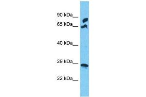 Western Blotting (WB) image for anti-Mitochondrial Ribosomal Protein S5 (MRPS5) (N-Term) antibody (ABIN2791673) (MRPS5 Antikörper  (N-Term))
