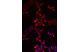 Immunofluorescence analysis of U2OS cell using PCBD1 antibody. (PCBD1 Antikörper)