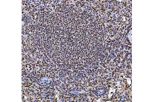 IHC analysis of hnRNP L/HNRNPL using anti-hnRNP L/HNRNPL antibody (ABIN7600130). (HNRNPL Antikörper  (AA 152-569))