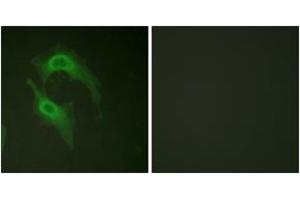 Immunofluorescence analysis of HeLa cells, using CD226/DNAM-1 (Ab-329) Antibody. (CD226 Antikörper  (AA 287-336))