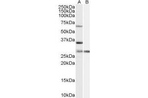ABIN2564748 (1µg/ml) staining of HeLa cell lysate (35µg protein in RIPA buffer) with (B) and without (A) blocking with the immunising peptide. (PRPF31 Antikörper  (Internal Region))