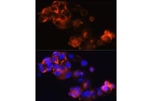 Immunofluorescence analysis of HepG2 cells using Glypican 3 (GPC3) (GPC3) Rabbit mAb (ABIN7267487) at dilution of 1:100 (40x lens). (Glypican 3 Antikörper)