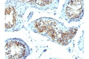 Immunohistochemistry (IHC) image for anti-Interferon gamma (IFNG) antibody (ABIN6939697)