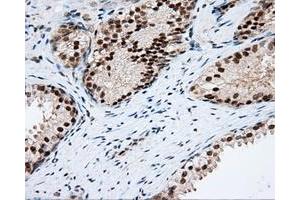 Immunohistochemical staining of paraffin-embedded Kidney tissue using anti-RC201933 mouse monoclonal antibody. (PIM2 Antikörper)