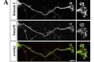 Hippocampal neurons were fixed at stage 3, stained with anti-Smurf2 (red) and anti-Kinesin-2 (green) antibodies, and analyzed by confocal microscopy. (SMURF2 Antikörper  (C-Term))