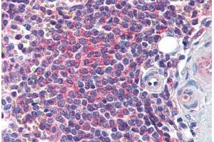 Human Spleen: Formalin-Fixed, Paraffin-Embedded (FFPE) (EDC4 Antikörper  (AA 1302-1402))