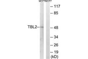 Western blot analysis of extracts from MCF-7 cells, using TBL2 Antibody. (TBL2 Antikörper  (AA 381-430))
