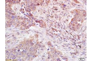 Immunohistochemistry (IHC) image for anti-ADAM Metallopeptidase with thrombospondin Type 1 Motif, 12 (ADAMTS12) (AA 301-450) antibody (ABIN685792)
