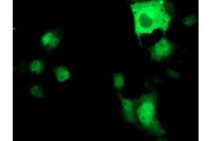 Anti-ATP6V1B1 mouse monoclonal antibody (ABIN2454300) immunofluorescent staining of COS7 cells transiently transfected by pCMV6-ENTRY ATP6V1B1 (RC209462). (ATP6V1B1 Antikörper)