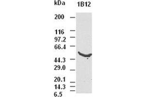 CK8 antibody (1B12) at 1:5000 dilution + Hela cell lysate (KRT8 Antikörper  (AA 91-381))