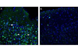 Expression of Orai1 in rat parietal cortex. (ORAI Calcium Release-Activated Calcium Modulator 1 (ORAI1) Peptid)