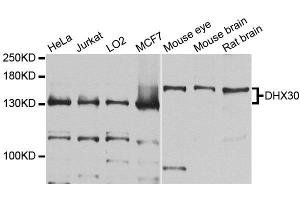 Western blot analysis of extracts of various cell lines, using DHX30 antibody (ABIN5996443) at 1/1000 dilution. (DHX30 Antikörper)