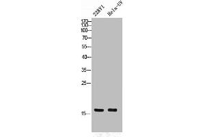 Western Blot analysis of 22RV1 HELA cells using Phospho-p16 (S326) Polyclonal Antibody (CDKN2A Antikörper  (pSer326))