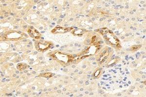 Immunohistochemistry analysis of paraffin-embedded human kidney using,TMEM213 (ABIN7075999) at dilution of 1: 2000