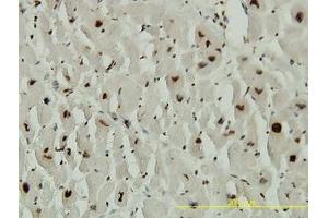 Image no. 1 for anti-Adrenocortical Dysplasia Homolog (ACD) (AA 1-545) antibody (ABIN599297) (ACD Antikörper  (AA 1-545))