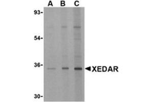 Image no. 1 for anti-Ectodysplasin A2 Receptor (EDA2R) antibody (ABIN318757) (Ectodysplasin A2 Receptor Antikörper)