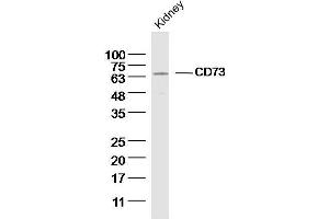 Mouse kidney lysates probed with CD73 Polyclonal Antibody, unconjugated  at 1:300 overnight at 4°C followed by a conjugated secondary antibody for 60 minutes at 37°C. (CD73 Antikörper  (AA 151-250))