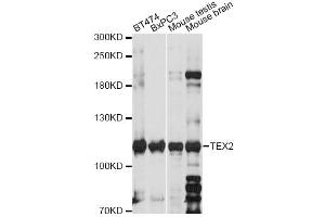 Western blot analysis of extracts of various cell lines, using TEX2 antibody (ABIN6293661) at 1:1000 dilution. (TEX2 Antikörper)